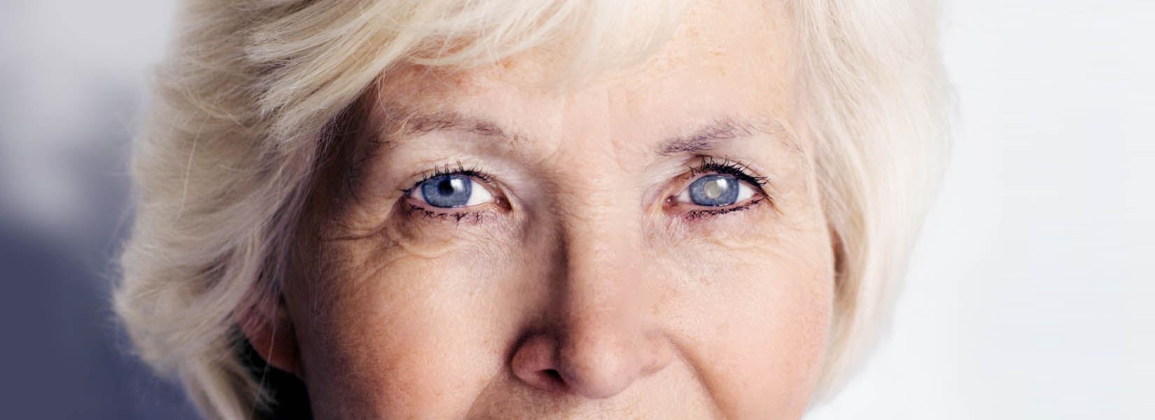 Cataract Surgery in Southeast Colorado Springs